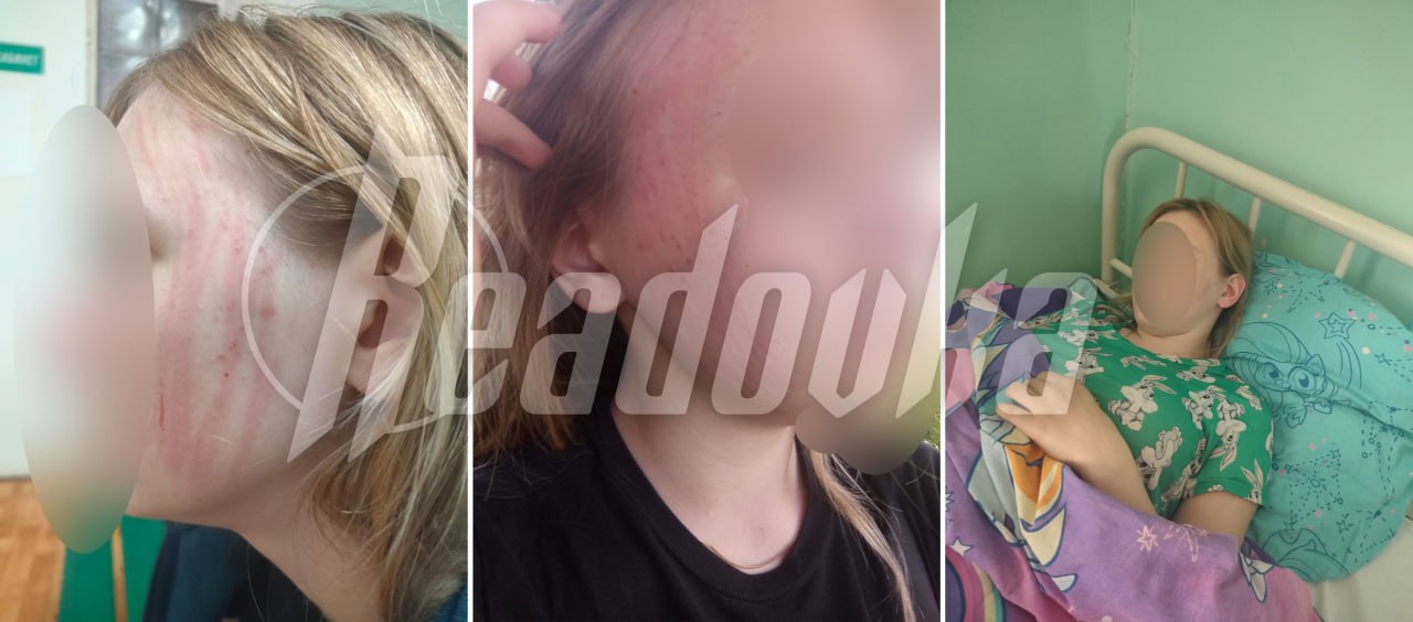 Во Ржеве водитель автобуса избил 14-летнюю девочку из-за того, что она не смогла доказать оплату проезда из-за проблем с интернетом Недалеко от Ржева неадекват-водитель напал на девочку из-за того, что она быстро не могла показать электронный чек на телефоне после оплаты проезда. Как рассказала мама Юли имя изменено , ее дочь возвращалась с подругой после тренировки домой на привычном автобусе №13. Подруга Юли оплатила проезд наличкой, а сама девочка по СБП, однако в этот момент связь пропала. Промедление с оплатой быстро вывело водителя из себя, и он с матом и криком принялся вымещать злобу на подростка кулаками, от чего девочка получила сотрясение. А после агрессор и вовсе выкинул Юлю из автобуса посреди поля. Мама сумела быстро приехать к дочери и доставить ее в больницу. Сам нападавший, по словам местных жителей, уже 10 лет водит автобус и за ним всегда наблюдалась агрессия к женщинам и детям. Сейчас неадекват задержан на 48 часов, проводится следствие - источник ИнформБюро-Россия