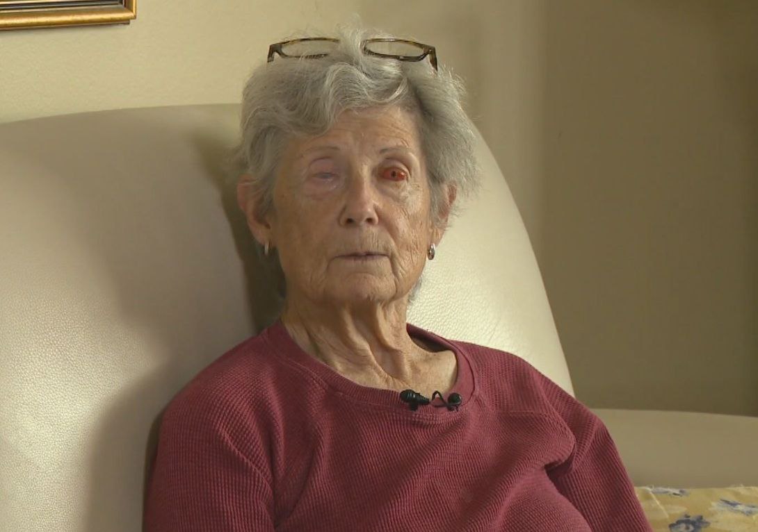 В Канаде женщине вставили зуб в глаз, чтобы она могла видеть  75-летняя Гейл Лейн полностью ослепла много лет назад из-за аутоиммунного заболевания, оставившего рубцы на роговицах её глаз.  Чтобы восстановить зрение, ей провели редчайшую операцию osteo-odonto keratoprosthesis  буквально «зуб в глаз» .  Сама операция максимально странная: — У пациентки извлекли собственный зуб; — Этот зуб вживили ей в щёку на несколько месяцев, чтобы он оброс соединительной тканью; — Затем в зубе просверлили отверстие и вставили в него миниатюрную оптическую линзу; — Получившийся биоимплант пересадили женщине в глаз, где он заменил повреждённую роговицу.  После операции зрение начало постепенно возвращаться: сначала Лейн увидела свет, потом — движение, затем контуры и цвета. Спустя месяцы она смогла разглядеть лица людей, включая лицо своего мужа, которого она никогда раньше не видела.  Какой-то проклятый биопанк