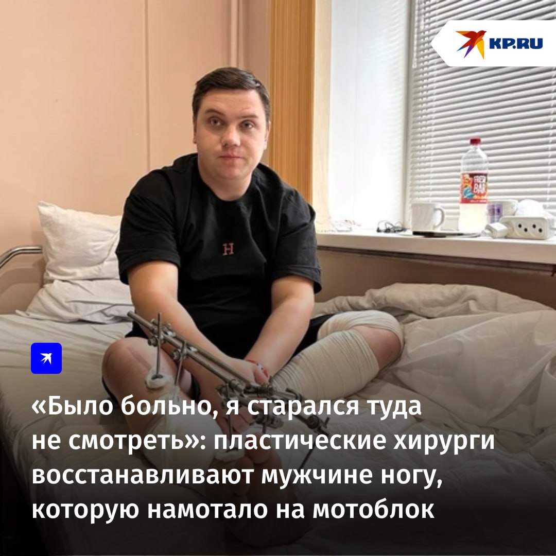Пластическая операция понадобилась 24 летнему многодетному отцу из города Верхний Уфалей Кирилл попал в ловушку собственной неосторожности во время вспашки огорода перед зимой мотоблок зажевал его сапог вместе с ногой В результате несколько костей переломаны а на голени не хватает большого куска кожи Чтобы сохранить ногу и обойтись без ампутации работают врачи разных профилей Одни собирают кость а другие пересадили кусочек кожи с живота на голень Кирилл рассказал о первых минутах после того как его ногу буквально зажевало а врачи о том как помогают таким непростым пациентам   Подписаться на chelkp