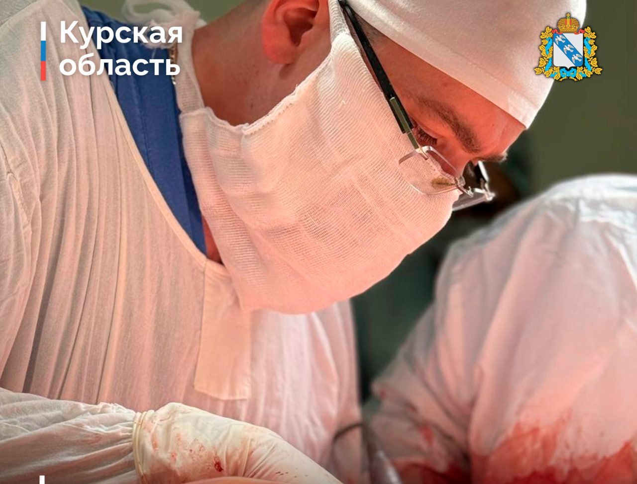 Врачи Курского онкоцентра удалили женщине 35-килограммовую опухоль Уникальную операцию провели курские медики. В мае 51-летняя жительница областного центра обратилась в скорую помощь с жалобами на боли в малом тазу и увеличенный живот. При обследовании с помощью КТ в брюшной полости было выявлено новообразование огромных размеров, исходящее из органов малого таза. Пациентка была перенаправлена в Курский онкологический научно-клинический центр имени Г.Е. Островерхова. В Центре была сформирована операционная бригада, а сама операция длилась пять часов. Размер опухоли достиг метра в длину и 60 см в диаметре. После операции женщину перевели в реанимационное отделение для дальнейшего восстановления, где за ней наблюдали в течение 7 суток. Пациентка уже выписана и чувствует себя удовлетворительно. В дальнейшем курянке предстоят восстановление и динамическое наблюдение. Фото: ВК Курская область