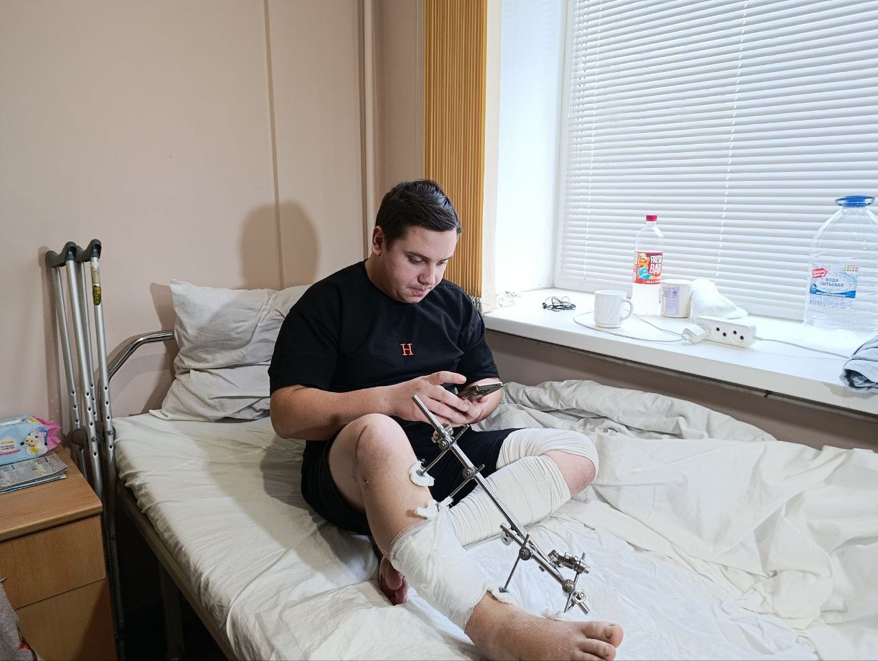 В ЧОКБ спасли ногу 24 летнему жителю Верхнего Уфалея В Челябинск санавиацией доставили 24 летнего мужчину с тяжёлой травмой голени перелом обеих костей повреждение мягких тканей и открытые связки После первой помощи по месту жительства его срочно перевезли в областную больницу где операция стала единственным шансом сохранить конечность В вмешательстве участвовали более десяти специалистов травматологи пластические хирурги и анестезиологи Врачи применили современные методики пластики пересадив ткани из малозаметной зоны чтобы избежать грубых рубцов и сохранить функцию ноги Сейчас лоскут успешно приживается восстановление идёт спокойно В больнице отмечают подобные случаи становятся возможными благодаря слаженной работе бригады и оперативности санавиации