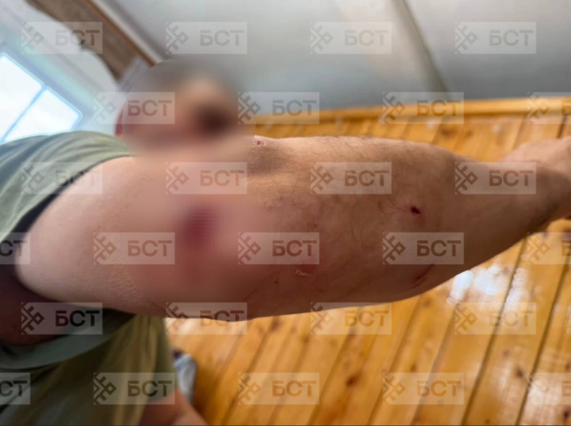 Рысь напала на человека В деревне Урюш-Битуллино в Башкирии рысь напала на местного жителя. Все обошлось - как видите, всего несколько царапин. Ему оказана необходимая медицинская помощь. А вот буйной рыси повезло меньше - люди не оценили её плохого настроения и ликвидировали животное. Будьте аккуратнее, природа - штука неожиданная и коварная. Источник: БСТ Моя Уфа. Подписаться Прислать новость