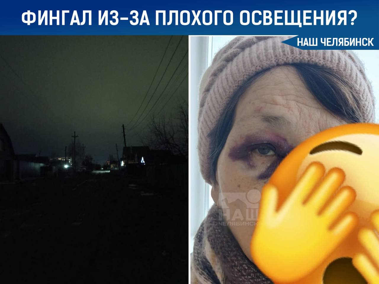 В Копейске женщина получила фингал из за плохого освещения Местные жители отмечают что город страдает от недостатка фонарей и плохих дорог отсутствуют тротуары много ям и грунтовки В администрации сообщили что мониторят жалобы и работают над их решением но объем проблем велик Женщина отделалась ушибом века но это не делает ситуацию менее неприятной Мы в ТГ ВК ОК MAX Не пропустите важные новости