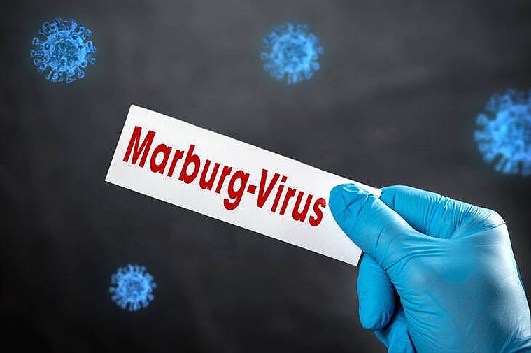 В Федеративной Демократической Республике Эфиопия зафиксирована вспышка лихорадки Марбург Некоторые СМИ сообщают о шести смертельных исходах включая гибель двух медицинских работников врача и медсестры которые оказывали помощь заболевшим Ситуация в России держится на контроле сообщил Роспотребнадзор Информация о вспышке лихорадки Марбург в Эфиопии находится на контроле Роспотребнадзора Специалисты ведомства проводят постоянный мониторинг ситуации и оценивают возможные эпидемиологические риски для Российской Федерации говорится на сайте ведомства На пограничных пунктах пропуска сотрудники Роспотребнадзора проводят усиленный санитарно карантинный контроль с применением автоматизированной информационной системы Периметр Цель мероприятий своевременное выявление лиц с симптомами инфекционных заболеваний в том числе прибывающих из регионов с неблагоприятной эпидемиологической обстановкой Ученые из Роспотребнадзора создали высокочувствительную тест систему для диагностики вируса Марбург