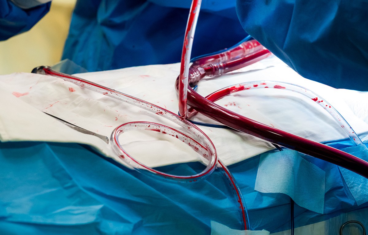 Челябинские врачи помогли женщине с огромной миомой матки родить ребенка gubernia74 ru articles society 1136755 В родильном доме клиники Южно Уральского государственного медицинского университета ЮУГМУ успешно прошли роды у женщины с гигантской миомой матки Опухоль размером около 20 сантиметров представляла серьезную угрозу как для матери так и для ребенка t me chgub