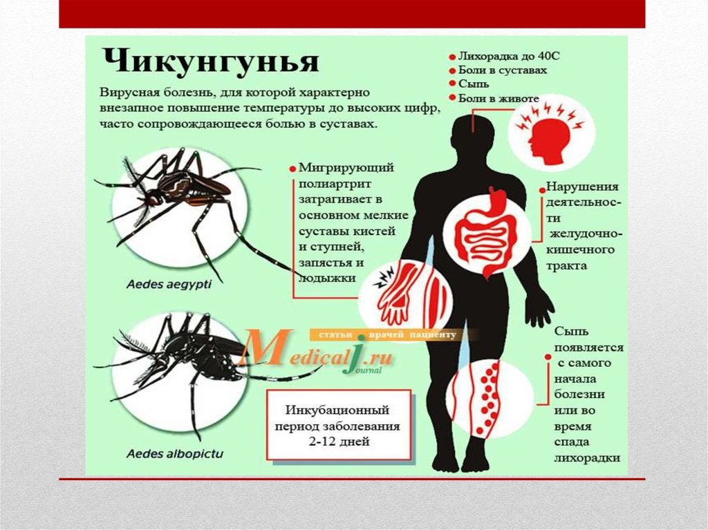 На Шри-Ланке — самая крупная вспышка лихорадки чикунгунья за 20 лет. Заболевание передаётся через укусы комаров, особенно активных днём. Симптомы — высокая температура, боли в суставах и сыпь — могут проявиться через 2–12 дней после заражения. Посольство России на Шри-Ланке призывает всех соблюдать меры предосторожности: — ставить москитные сетки на окна и двери, — использовать репелленты, — носить закрытую одежду, особенно днём. На заметку тем, кто сейчас на острове — или собирается туда в ближайшее время.
