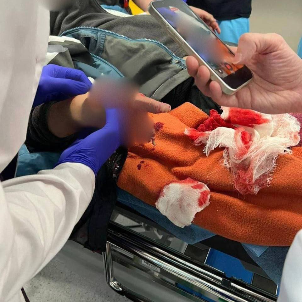 В Красногорске ребенок 9 лет подорвался на взрывном устройстве подняв пачку денег лежавшие рядом с детской площадкой В результате ребенок госпитализирован с ампутацией нескольких пальцев руки Инцидент произошел вечером на Пионерской улице Территорию оцепили на месте работают следователи и взрывотехники проверяют записи с камер и опрашивают свидетелей