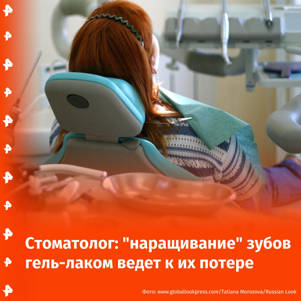 Тренд на "наращивание" зубов с помощью гель-лака опасен — такие манипуляции могут привести к их потере. Об этом РЕН ТВ рассказала хирург-стоматолог, челюстно-лицевой хирург, ортопед Вероника Мелехова. По словам медика, люди все чаще стали пользоваться подобной услугой из-за ее дешевизны. Однако применяющие гель-лак мастера маникюра таким образом только вредят пациенту. "Они не могут обработать полость рта должным образом. Бактерии начнут размножаться с сумасшедшей скоростью во много раз быстрее, чем они до этого размножались", — подчеркнула стоматолог. В связи с этим у нарастившего себе зубы человека могут возникнуть пульпит и периодонтит. Как отметила Мелехова, гель-лак не только запечатывает микробы, но и имеет токсичный состав. Из-за этого подобные манипуляции могут повредить зубы и десны, вызвать ожог или аллергическую реакцию. Врач посоветовала не пользоваться таким "народным" методом, а обратиться к стоматологу. В противном случае приклеившийся к зубам лак придется спиливать вместе с эмалью. Отправить новость