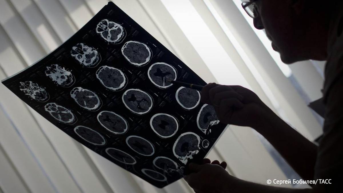 Выявлены связанные с болезнью Альцгеймера сбои в работе иммунитета кишечника сообщает Институт изучения старения имени Бака Развитие болезни Альцгеймера сопровождалось сдвигами в работе 560 участков ДНК большинство из которых затрагивало работу двух типов B клеток телец иммунной системы отвечающих за выработку антител Подпишись на ТАСС Наука