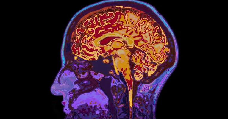 Мозг человека начинает стареть в 36 39 лет До этого мозг может продуцировать какие то идеи потом он уже живет с тем багажом который у него есть У каждого старение идёт по разному влияет в т ч генетическая предрасположенность UFA RB Подписаться Прислать новость