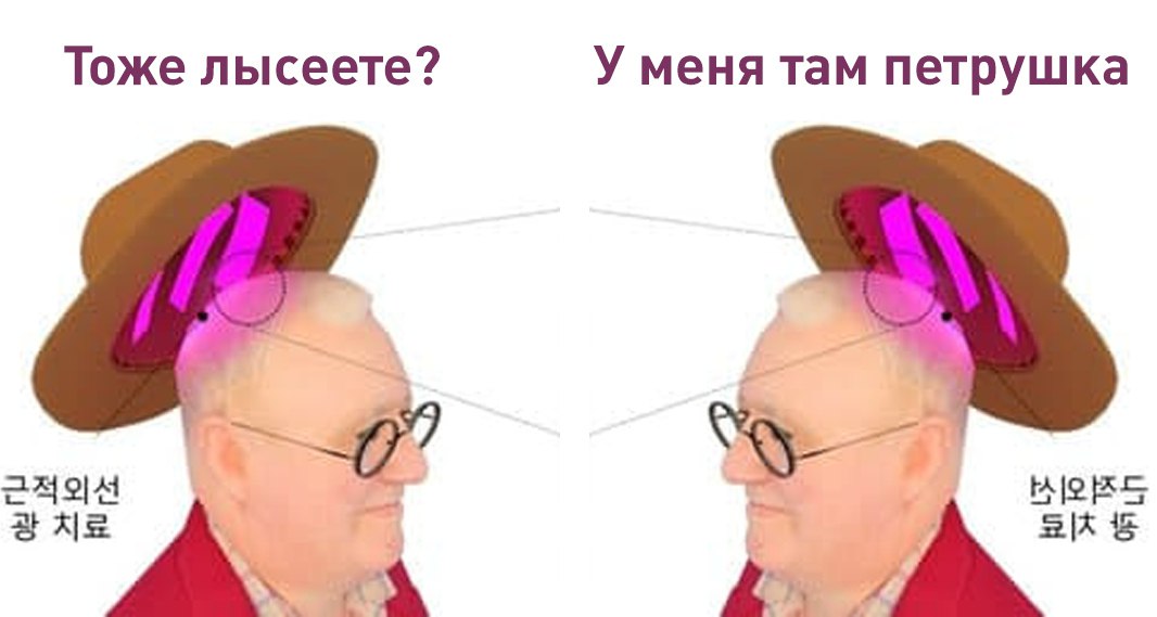 Южнокорейские учёные создали светодиодную шляпу от выпадения волос По словам авторов устройства инфракрасные OLED светодиоды замедляют старение волосяных фолликулов до 92 А что ещё случилось