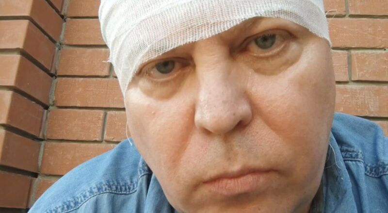 Обвиняемым в покушении на Михаила Матвеева запросили до 11 лет колонии На депутата Госдумы напали летом прошлого года В Самаре обвиняемым в покушении на депутата Госдумы Михаила Матвеева запросили реальные сроки В суде Промышленного района Самары начались прения по уголовному делу На девятой просеке в Самаре 18 июля прошлого года Матвеев заметил уличную драку в которой участвовали трое мигрантов По словам парламентария они шли от набережной и приставали к прохожим Политик вышел из машины достал удостоверение и попытался разнять дерущихся Весь процесс ему удалось заснять на видео Остановил нападение Матвеев ценой собственного здоровья Успев только сказать Остановитесь парламентарий получил ощутимый удар по голове Двое участников драки сбежали Одного из них гражданина Узбекистана 2004 г р удалось задержать до приезда полиции Рану на голове Матвеева пришлось зашивать в больнице Депутат отметил что долго ожидал скорую помощь и полицию около 40 минут Сначала было возбуждено уголовное дело о хулиганстве Затем по поручению главы Следственного комитета России Александра Бастрыкина действия нападавших переквалифицировали на покушение на убийство Представитель гособвинения запросил 9 5 года колонии строгого режима Мусурову и 11 лет колонии строгого режима Бохирову а также 6 5 года воспитательной колонии для несовершеннолетнего обвиняемого Прения продолжатся 28 ноября В суде планируется выступление защиты подсудимых и Михаила Матвеева