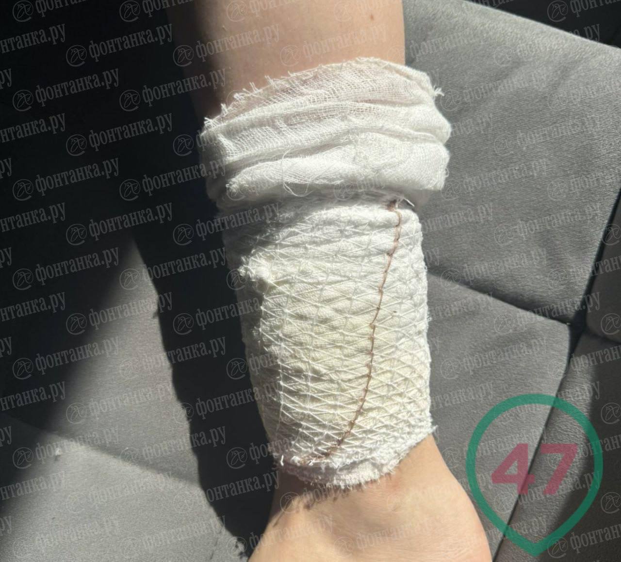 «Кабанчик» из Петербурга: школьницу укусил вьетнамский свин у школы В Выборгском районе Петербурга произошёл неожиданный инцидент — вьетнамский кабан покусал 12-летнюю девочку у школы на улице Жени Егоровой. История прозвучала из первых уст: «Смотрю — кабанчик. Подошли с подругой. Я гладить побоялась, а подруга — нет. Рядом стояли женщина с яблоком и парень. Женщина скормила яблоко, мы начали отходить… и тут он завибрировал весь, жир затрясся и побежал на меня. Успел за ногу цапнуть. Я в кровь. Подруги довели до дома, папа промыл, мама приехала». Теперь пострадавшую девочку ждёт курс уколов от бешенства и приём антибиотиков. Полиция уже опросила предполагаемого владельца «наижирнейшего» свина так его охарактеризовала мама пострадавшей , но привлечь его к ответственности пока не удалось — ведомства переводят стрелки друг на друга, а в администрации Выборгского района и вовсе игнорируют звонки журналистов. Тем временем специалисты предупреждают: опасность недооценивать нельзя. «Дикая свинья разрывает косулю. Даже медведь на них не нападает — это две сотни килограммов ярости», — сообщил охотник Геннадий Волков. Животное пока гуляет на свободе.