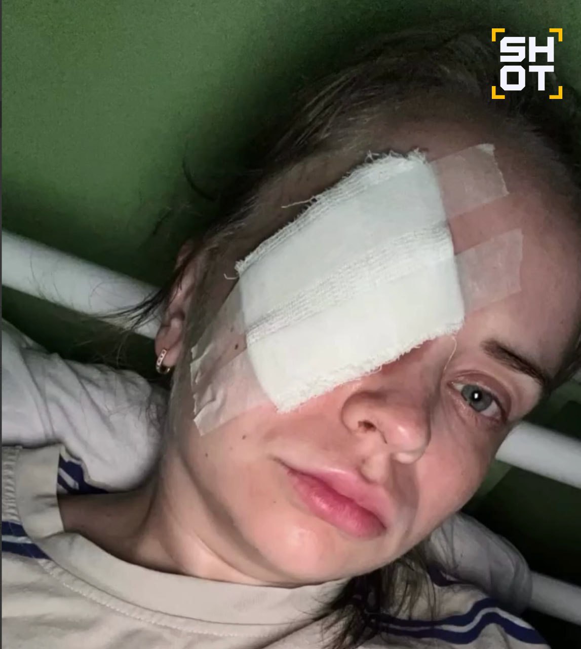 Жительница Перми получила пулю в глаз на пробежке. Врачи утверждают, что пострадавшая может остаться без глаза Как рассказала SHOT Светлана, накануне около 16 часов дня она вышла на пробежку на улице Макаренко. В какой-то момент у неё резко заболело лицо и она почувствовала, как из глаза идёт кровь. К ней тут же подошли очевидцы, которые предложили вызвать скорую. Девушку экстренно доставили в больницу, где провели операцию и вытащили металлический предмет из глаза. Оказалось, что это была пуля. Сейчас она находится в стационаре. По словам девушки, врачи не знают, смогут ли спасти глаз, который сейчас очень сильно болит. Светлана уже написала заявление в полицию.