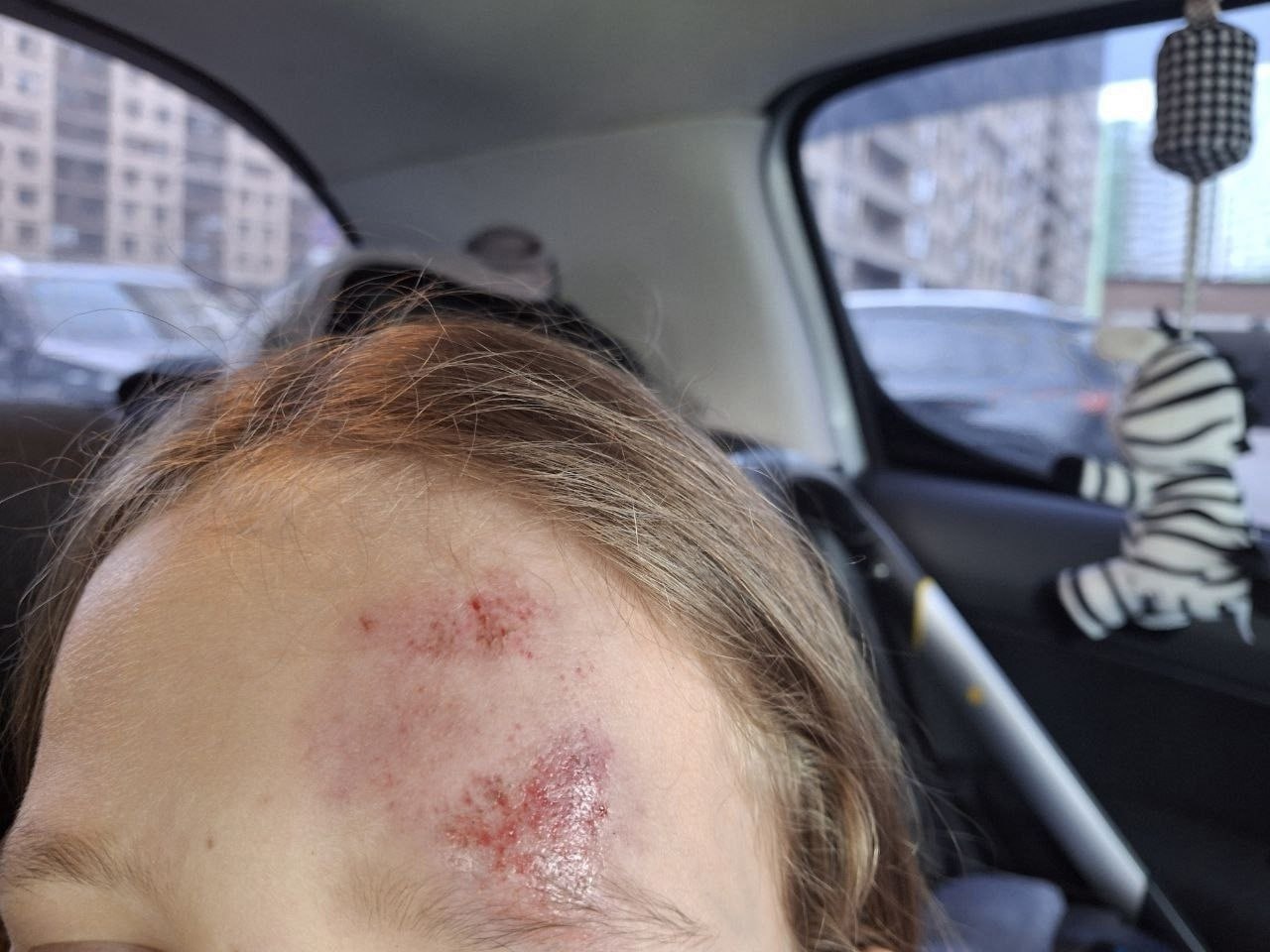 Самокатчик сбил девочку в Кудрово и скрылся. Очередной пострадавшей от пользователей электросамокатов стала юная жительница Ленобласти. Инцидент произошёл около 15:00 12 июня напротив дома №21, корпус 2 на Европейском проспекте. Родители пострадавшей рассказали в соцсетях, что мужчина на электросамокате ехал по дороге и сбил ребёнка на выходе из парка, после чего ничем не помог и скрылся. Они ищут очевидцев инцидента, чтобы вычислить самокатчика. СК возбудил уголовное дело по статье о хулиганстве. Места СПб Новости СПб