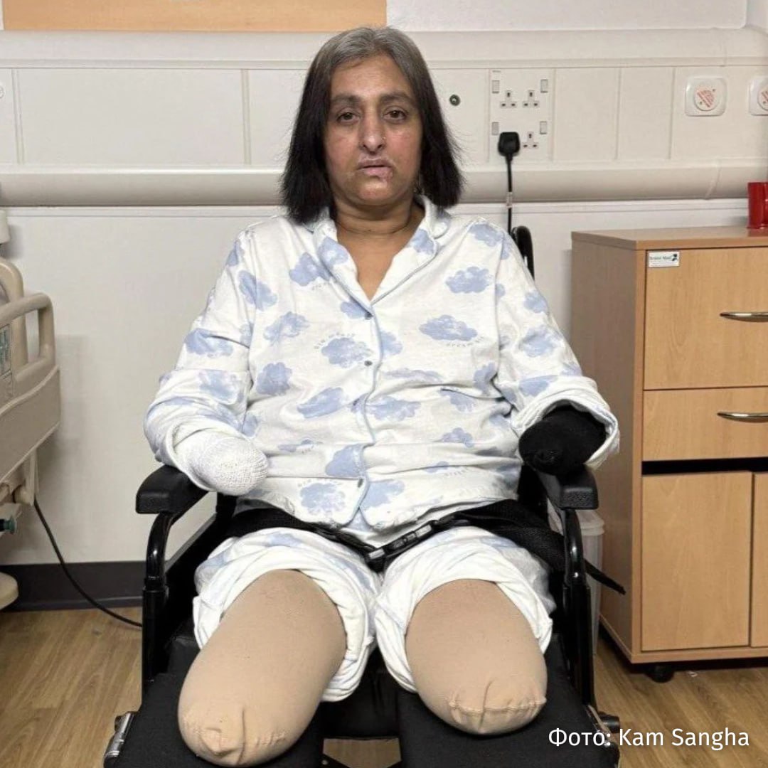 Британке ампутировали все конечности после того как ее облизала собака Об этом пишет Telegraph В июле прошлого года Манджит Сангха поиграла с собакой сходила на работу вернулась домой и почувствовала себя плохо После этого женщина потеряла сознание ее госпитализировали В больнице ее сердце останавливалось шесть раз Хирургам пришлось ампутировать ей обе ноги ниже колена обе руки и удалить селезенку поскольку женщина также боролась с пневмонией и камнями в желчном пузыре Медики предположили что главной причиной ухудшения состояния пациентки стал сепсис предположительно вызванный тем что собака лизнула ей небольшую царапину во время игры Манджит Сангха провела в больнице 32 недели После выписки она заявила что до сих пор не может смириться с ампутацией всех четырех конечностей РЕН ТВ ждет вас в MAX