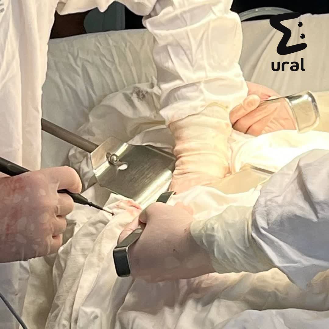 Черви семь лет жили в теле челябинца. Всё это время его лечили от простатита. 44-летний мужчина годами ходил по врачам с жалобами на боли и симптомами классической болячки. Оказалось, что в нём просто жили паразиты. Эхинококковые кисты с личинками нашли в печени, животе и, собственно, в простате. Это очень редкий случай. Сначала врачи притормозили развитие инфекции химиотерапией. После провели пятичасовую операцию. Хирурги буквально развернули печень, чтобы добраться до одной из кист у крупного сосуда. Сейчас мужчина идёт на поправку. Уверен, что заразился много лет назад в казахстанском селе, где держал хозяйство. worms: the end