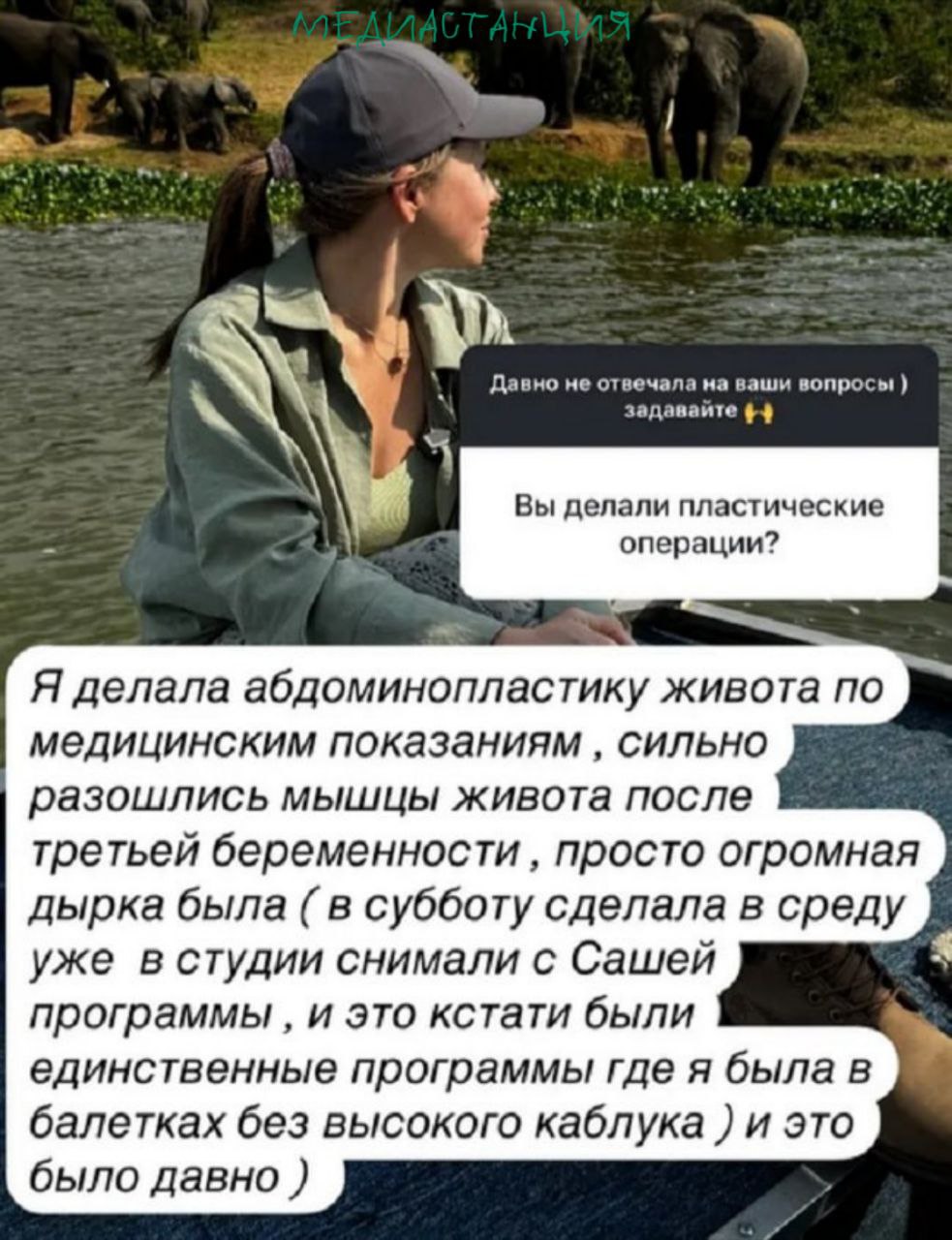 Юлию Барановскую по данным SHOT экстренно госпитализировали Как сообщает Telegram канал телеведущей стало плохо во время съемок на Ямале Предполагают что причиной могли стать осложнения после абдоминопластики живота которую журналистка сделала после третьих родов по медицинским показаниям Вдобавок к операции стресса ей наверняка добавила и тяжба с бывшим мужем долларовым миллионером Андреем Аршавиным которому жалко денег на алименты своим детям Скорейшего выздоровления Юле mediastanciacom