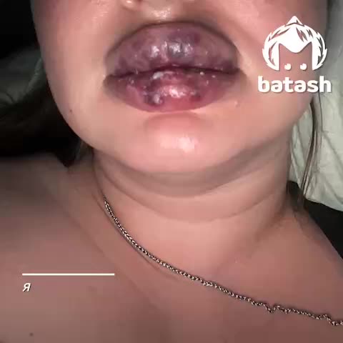 Во Владивостоке клиентка устроила драку с мастером по ресницам из-за неудовлетворительного результата