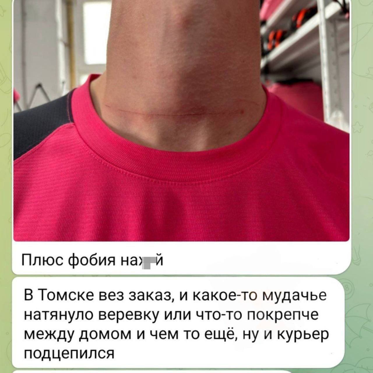 В Томске кто-то начал натягивать проволоки между домами, чтобы остановить там движение самокатчиков и мотоциклистов — ловушка чуть не отрубила голову курьеру! Такие подлянки могут быть смертельно опасны для велосипедистов, мотоциклистов, самокатчиков и бегунов. — найти урода, который это делает, и оторвать руки! Рифмы и Морген