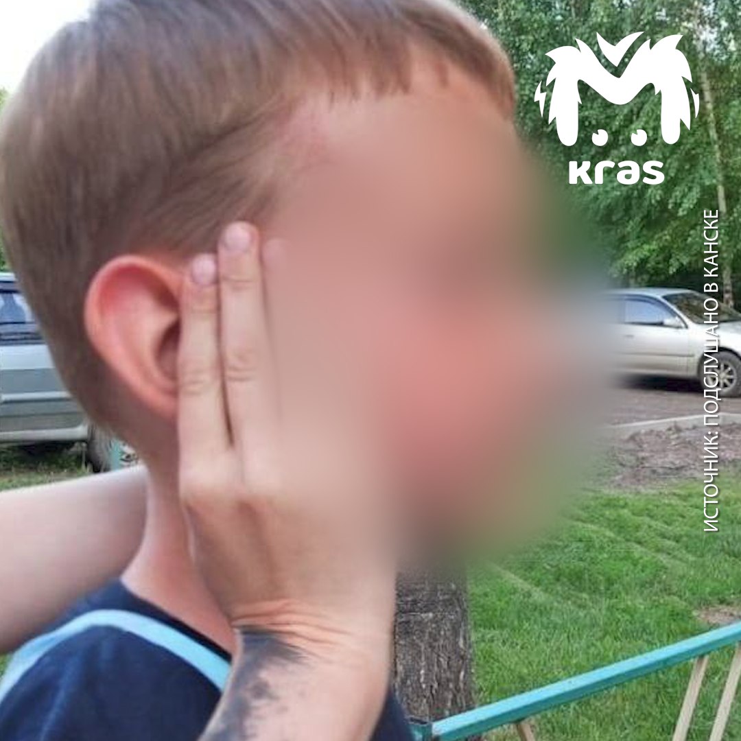 Мать из Канска несколько лет мучила маленького сына. На неё завели уголовное дело. По версии следствия, 37-летняя женщина била шестилетнего ребёнка и издевалась над ним. Побои заметили взрослые, когда он вышел гулять. После этого его вместе с младшим братом ему два забрали из семьи. На учёте семья не стояла. Подозреваемую задержали, скоро ей изберут меру пресечения.