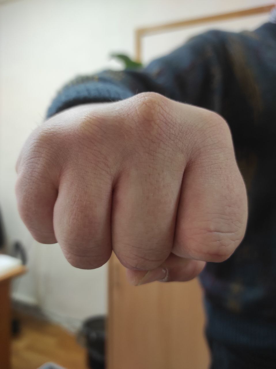 В Курской области парень лишил женщину глаза. Инцидент случился в январе в Конышевском районе. 21-летний молодой человек напился и уснул у своей знакомой. Сестра девушки, когда пришла домой, пыталась выпроводить неизвестного гостя, за что тот жестоко её избил. В результате потерпевшей из-за полученных травм пришлось удалить глаз. Сейчас уголовное дело по факту причинения тяжкого вреда здоровью направлено в суд для рассмотрения. Курская Telega / Прислать новость