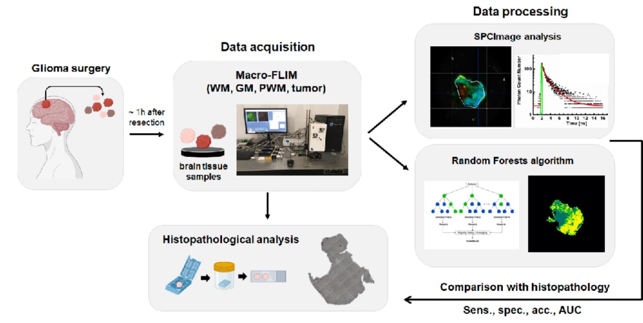 Ученые с 87 точностью диагностировали опухоли головного мозга по свечению тканей Ученые предложили технологию для высокоточной диагностики опухолей головного мозга Метод основанный на анализе флуоресценции собственного свечения тканей позволил с точностью до 87 выявить новообразования и определить зоны инфильтрации места где раковые клетки проникают в окружающие здоровые ткани Разработка поможет точнее определять границы злокачественных опухолей в головном мозге и тем самым повысить эффективность хирургического вмешательства для их удаления Результаты исследования поддержанного грантом Российского научного фонда РНФ опубликованы в журнале Biomedical Optics Express neuronovosti ru uchenye s 87 tochnostyu diagnostirovali opuholi golovnogo mozga po svecheniyu tkanej
