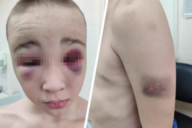 В Новосибирске инструктор частного спортивного центра пойдет под суд по обвинению в истязании воспитанников. Об этом сообщили в пресс-службе прокуратуры по Новосибирской области. По версии следствия, Данил Шарган систематически наносил ученикам ушибы деревянными палками, а также удары по голове неустановленными предметами в период с ноября 2023 года по март 2024 года. Ему инкриминируют пункты «а», «г» части 2 статьи 117 УК РФ – истязание. Суд рассмотрит дело по существу. #новосибирск