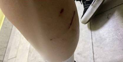 Бродячие псы напали на 16-летнюю девушку в Минводах. Ей потребовалась медицинская помощь, но сейчас здоровью ничего не угрожает. Следователи начали проверку. Подписаться прислать новость