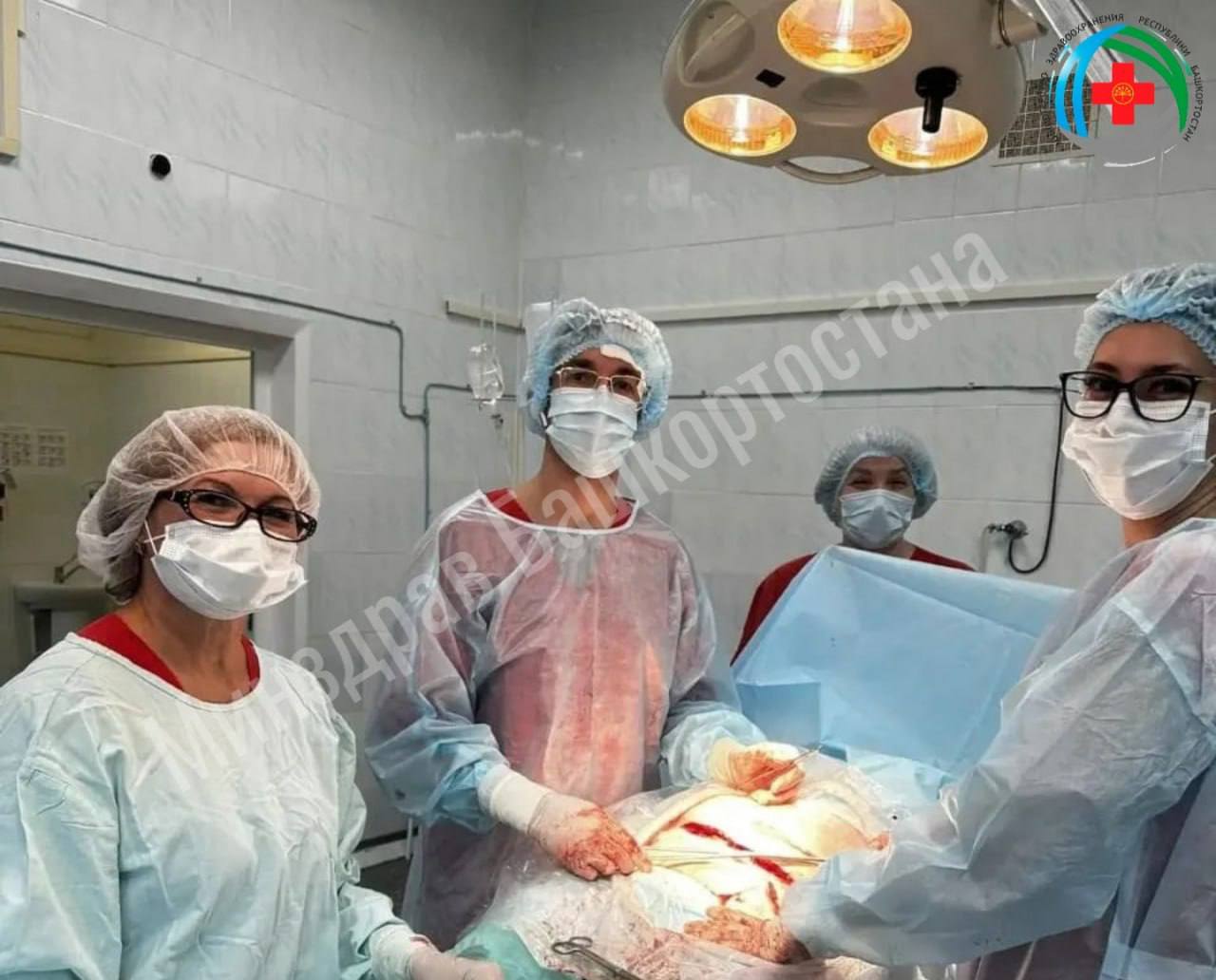 Уфимские врачи спасли жизнь матери и новорождённого при сложных родах В Уфе медикам удалось спасти жизнь женщины и её малыша во время тяжёлых родов Беременность изначально протекала с серьёзными осложнениями у будущей мамы было сразу три рубца на матке после предыдущих операций предлежание плаценты и её опасное врастание в рубец Всё это создавало высокий риск массивного кровотечения и угрожало жизни сразу двоих Во время операции ситуация стала критической кровопотеря достигла трёх литров Врачи Республиканского перинатального центра действовали быстро и слаженно они сделали всё чтобы сохранить женщине матку и не допустить переливания донорской крови Для этого применили аутогемотрансфузию кровь собранную во время операции очистили и вернули пациентке В результате на свет появился малыш весом всего 1 250 граммов Несмотря на сложность ситуации врачам удалось спасти и ребёнка и его маму Женщина сейчас восстанавливается после тяжёлой операции а малыш проходил лечение в отделении патологии новорождённых и недоношенных детей Сейчас маму с крохой перевели в 17 ю больницу где они продолжают получать необходимую помощь UFA RB Подписаться Прислать новость Подпишитесь на нас в МАХ