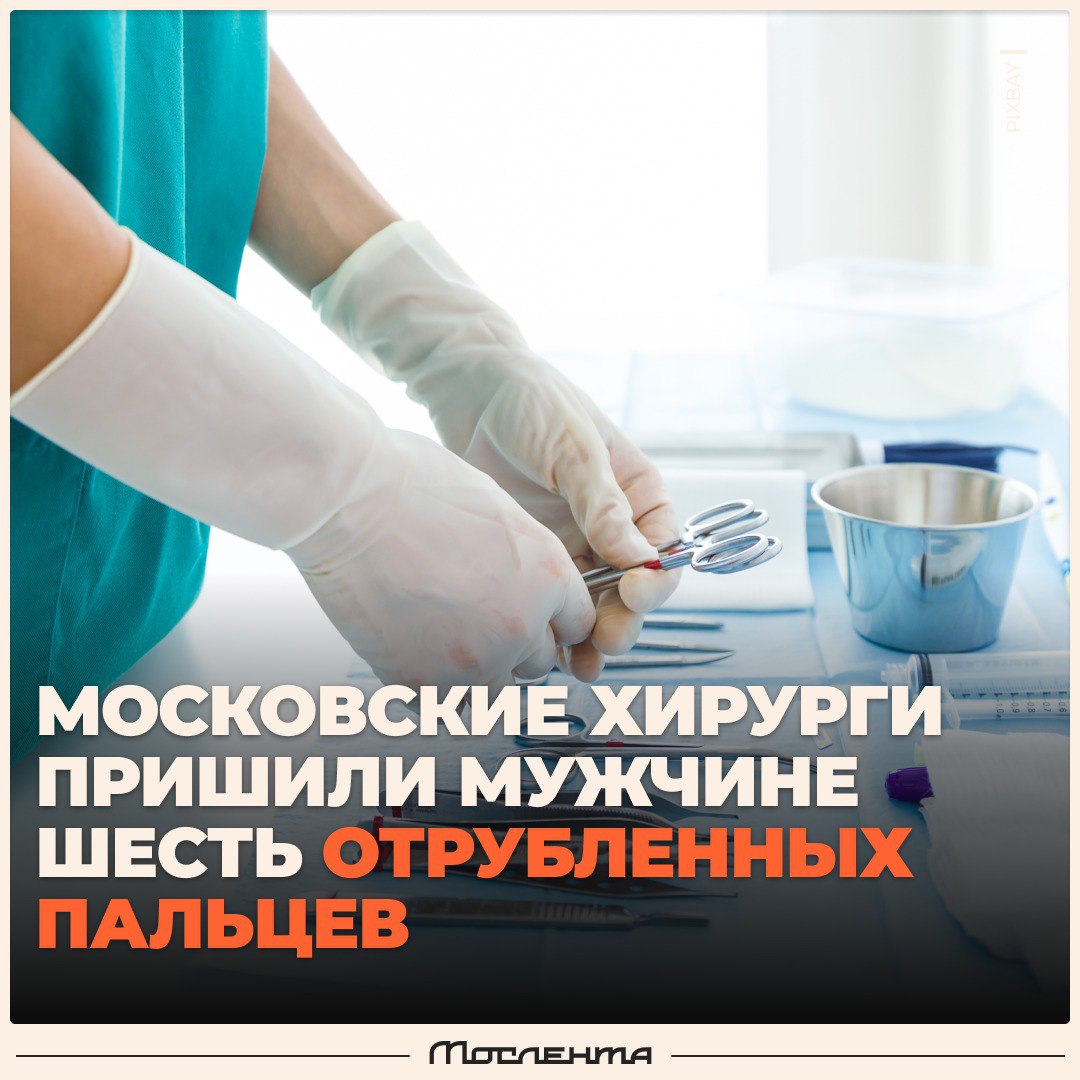 Московские врачи пришили мужчине шесть отсечённых пальцев Мужчина во время ремонта отрезал себе пальцы на его руку упал металлический профиль Пострадавший сам обратился в Центр где ему оперативно провели реплантацию Две операции заняли 14 и 10 часов В итоге врачи пришили пострадавшему шесть из семи пострадавших пальцев сохранив фактически функциональность обеих рук   спасибо врачам профессионалам moslentaru