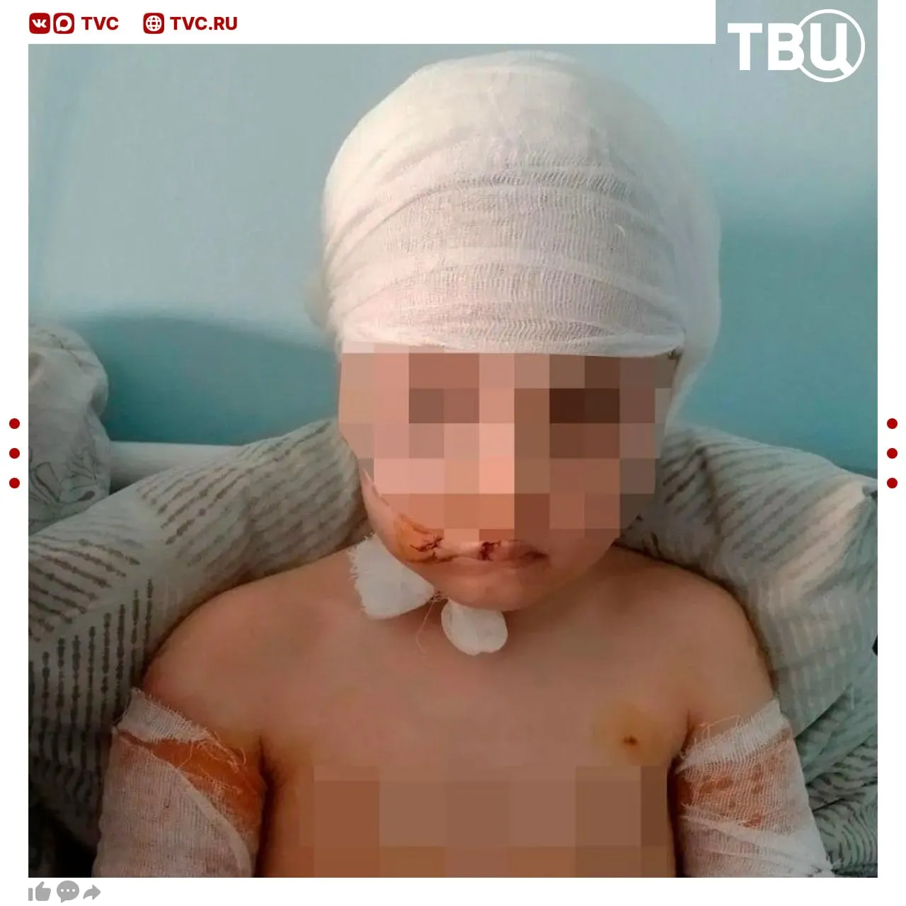 Бездомные собаки напали на пятилетнюю девочку в Красноярском крае Она получила множество ран на руках лице и голове Инцидент произошел когда отец отошел в магазин оставив дочку на детской площадке Стаю собак отогнал проезжавший мимо мужчина СК возбудил уголовное дело о халатности В региональной прокуратуре отметили что администрация в поселке Диксон должна была организовать отлов животных в 2024 году но так и не сделала этого Не грузятся фото и видео Читайте ТВЦ в MAX