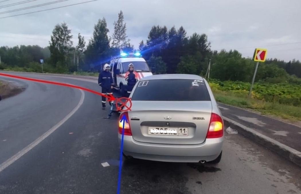 На объездной дороге в Сыктывкаре питбайкер врезался во встречный автомобиль Молодой человек вез 17-летнего пассажира будучи пьяным. Оба они не позаботились о защитных шлемах. Водительского удостоверения у мотоциклиста тоже не было.