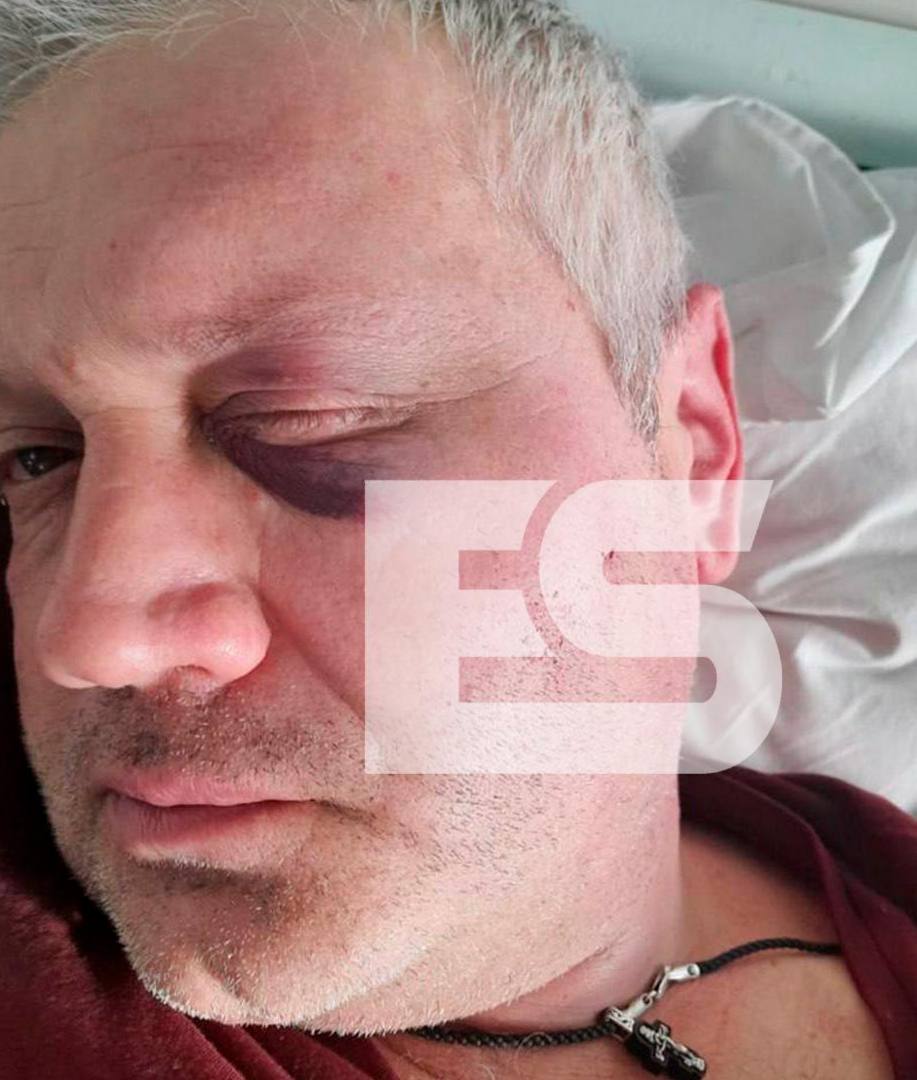 После огласки в СМИ обнинская полиция проводит проверку по факту избиения отца семейства в подъезде Между местными жителями неоднократно возникали конфликтные ситуации а 12 декабря один из них приехал к дому другого и избил Оба гражданина опрошены Пострадавшего направили на судмедэкспертизу Ранее конфликты решались без полиции заявлений не поступало Решение в рамках закона правоохранители примут по результатам проверки Наш канал в MAX