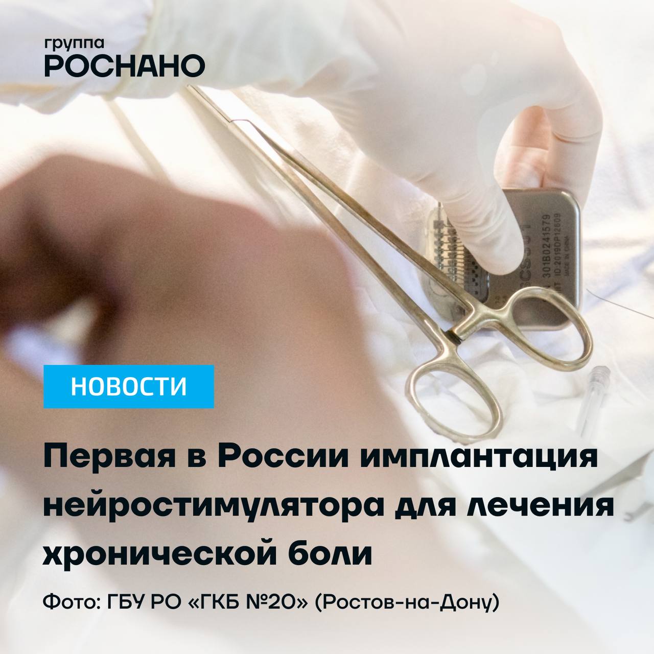 «Моторика» провела первую в России имплантацию нейростимулятора для лечения хронической боли с дистанционным управлением  В Городской клинической больнице №20 Ростова-на-Дону состоялась уникальная операция по имплантации нейростимулятора для лечения хронических болей с возможностью дистанционного программирования. Операция прошла при участии компании «Моторика НЕМО»  Группа «Моторика» , которая вывела нейростимулятор на российский рынок в конце 2024 года.   «Системы нейростимуляции применяются в нашей стране достаточно давно. Однако ранее ее проводили с внедрением импланта ручного программирования. Для проведения корректировки пациенты были вынуждены часто посещать врача-хирурга. Мы внедрили нашей пациентке нейроимплант SCS, который позволяет управлять всеми корректировками удаленно. Эта операция оказалась единственной мерой, которая избавила нашу пациентку от хронических болей, беспокоящих её на протяжении долгих лет» — рассказал врач-нейрохирург ГБУ РО «ГКБ №20» Ростова-на-Дону Андрей Лысенко.  Имплантированное устройство входит в систему стимуляции спинного мозга  SCS  и используется для лечения хронических болевых синдромов, не поддающихся коррекции лекарственными средствами. Устройство изготовлено компанией Rishena Medical Co., Ltd. Его особенность — наличие двух программаторов: один для врача, другой для пациента. Благодаря этому пациенты при необходимости смогут получать коррекцию лечения, не выходя из дома.  Группа «РОСНАНО» владеет долей в компании «Моторика» через ДВФТ и является инвестором ранней стадии в проект.