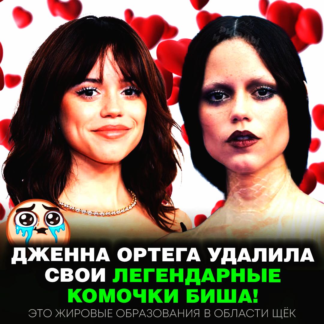 Дженна Ортега удалила Комочки Биша — фанаты в трауре!  Актриса убрала жировые образования, расположенные в области щёк, между кожей и мышцами.     — вроде так даже лучше, да и её тело = её дело   — А СКОЛЬКО ОПЫТА ДАЮТ ЗА ТАКУЮ?    Рифмы и Морген