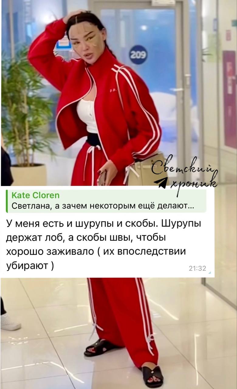 Тимур Хайдаров сделал из жены невесту Франкенштейна. Лицо ей натянули и зафиксировали намертво с помощью скоб и шурупов