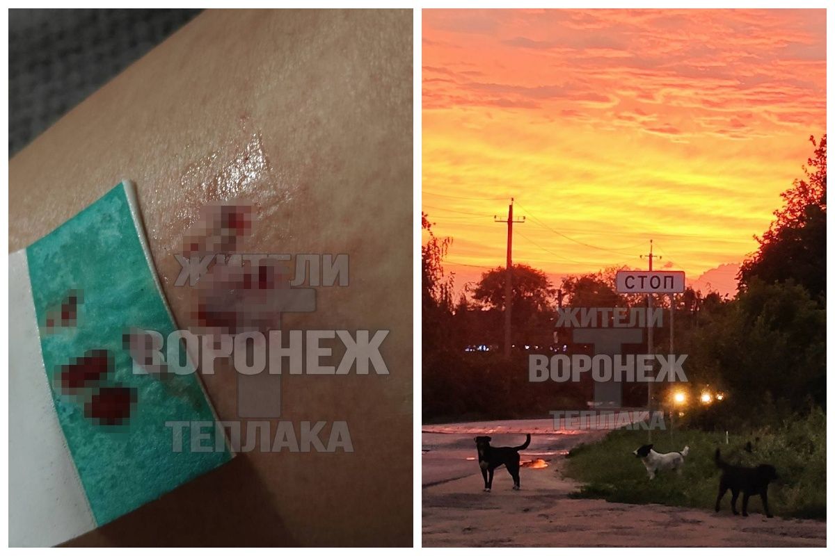 Стая диких собак напала на жительницу Воронежа в микрорайоне Тепличном     Инцидент произошел вечером 20 июля. Девушка шла домой и остановилась сфотографировать закат. Однако неподалеку оказались обитатели этих мест — агрессивные бездомные собаки. Здесь и ранее случалось, что псы бросались на детей, взрослых и домашних собак.  ↗  Прислать новость   Подписаться