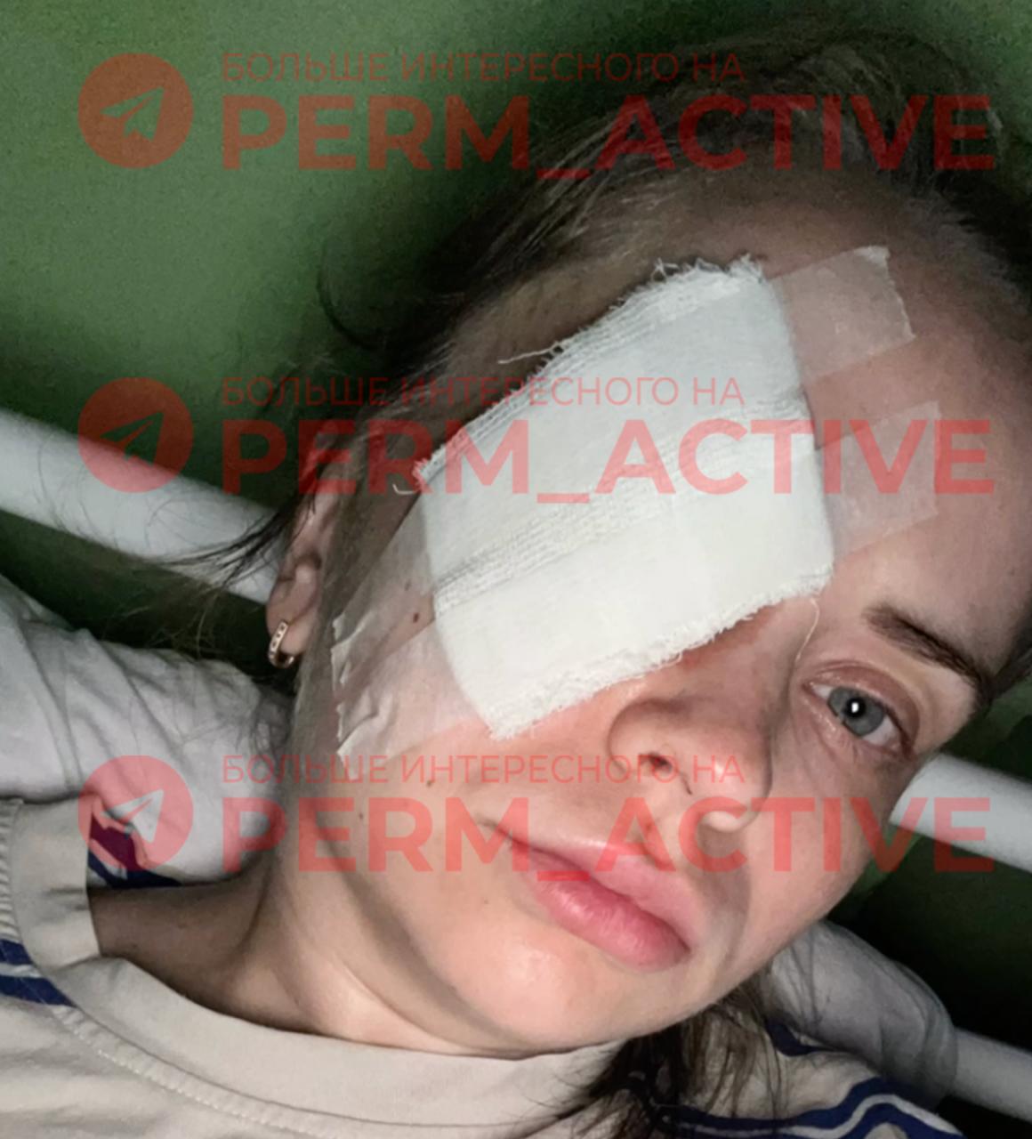 Пермячка едва не лишилась глаза во время пробежки в парке Все произошло вечером в микрорайоне Городские горки. Девушка почувствовала сильную боль и увидела кровь. Оказалось, что кто-то выстрелил в нее из пневматики. Ребята-скейтеры вызвали пострадавшей скорую. Сейчас она находится в больнице после проведенной на глазу операции. Будет ли травмированный глаз видеть, как раньше – врачи пока не знают. По факту произошедшего полиция проводит проверку. Пермь Активная ТГ Подписаться Дать «буст»