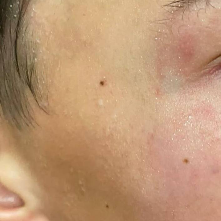 Подростки разбившие клумбу 90 летней бабушки у дома 26 на улице Циолковского избили 14 летнего школьника По словам отца мальчика ребенок сидел в беседке вместе с другими детьми Мимо прошла девушка и сделала им замечание Спустя несколько минут она вернулась с вооруженными подростками Школьник попал в больницу с сотрясением мозга Подписаться Написать нам