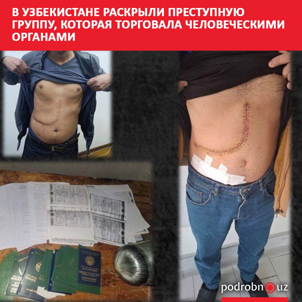 Сотрудники СГБ и МВД пресекли деятельность организованной группы занимавшейся торговлей человеческими органами и тканями Только за последние два года ее услугами воспользовались 32 человека podrobno uz cat proisshestviya v uzbekistane raskryli gruppu kotoraya torgovala chelovecheskimi organami Telegram Instagram Facebook Читать на узбекском