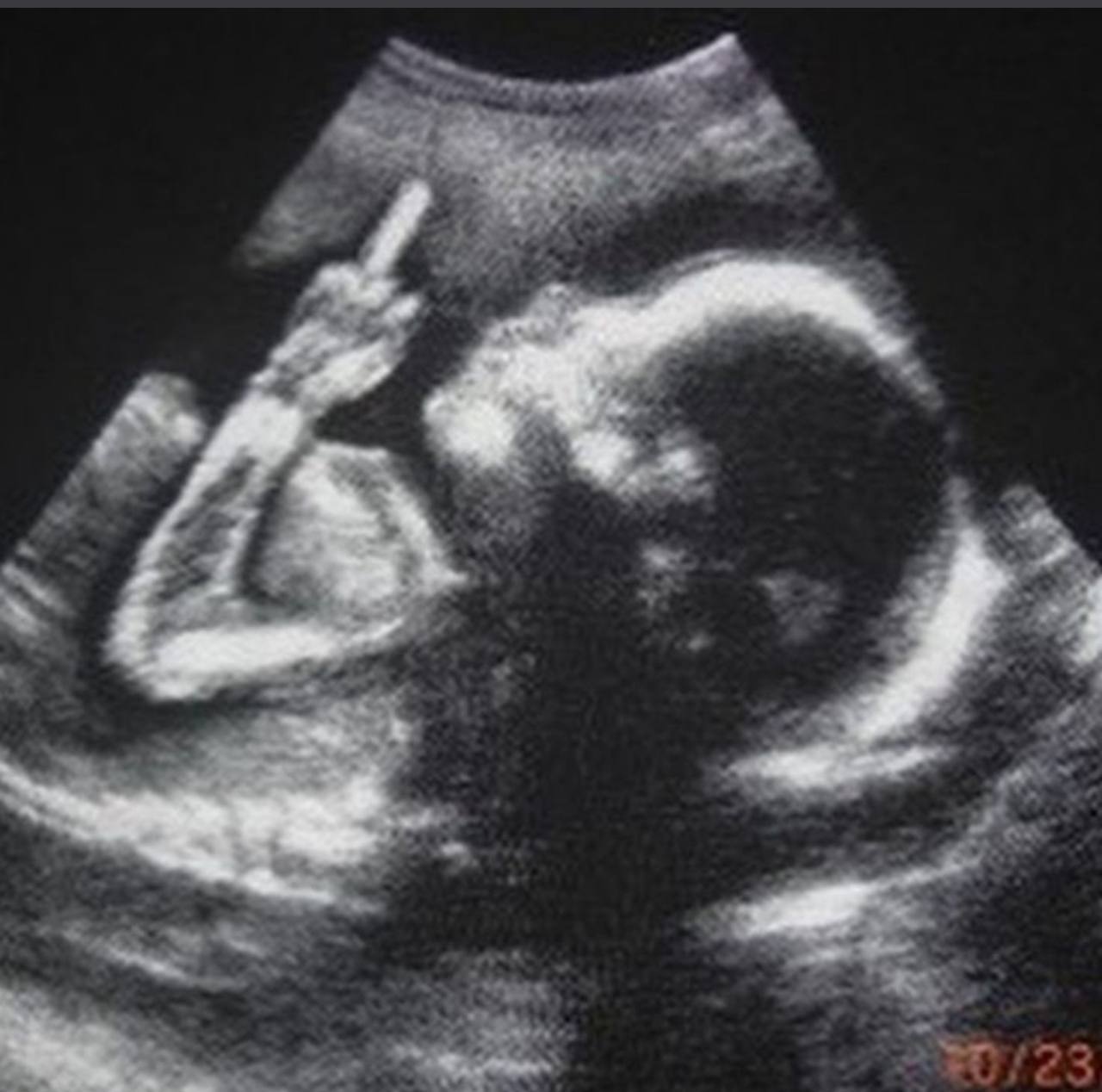 Курганская возлюбленная выманила у екатеринбуржца полмиллиона притворяясь беременной Дело возбудили против 24 летней жительницы Шумихи По версии полиции девушка разыграла перед парнем роман с беременностью и родами получив от него почти полмиллиона рублей на медуслуги и покупки для малыша Когда мужчина захотел оформить отцовство сказка рассыпалась ребёнка не существовало Теперь подозреваемой грозит до шести лет за мошенничество Подписаться Прислать новость Дать буст Мы в МАХ