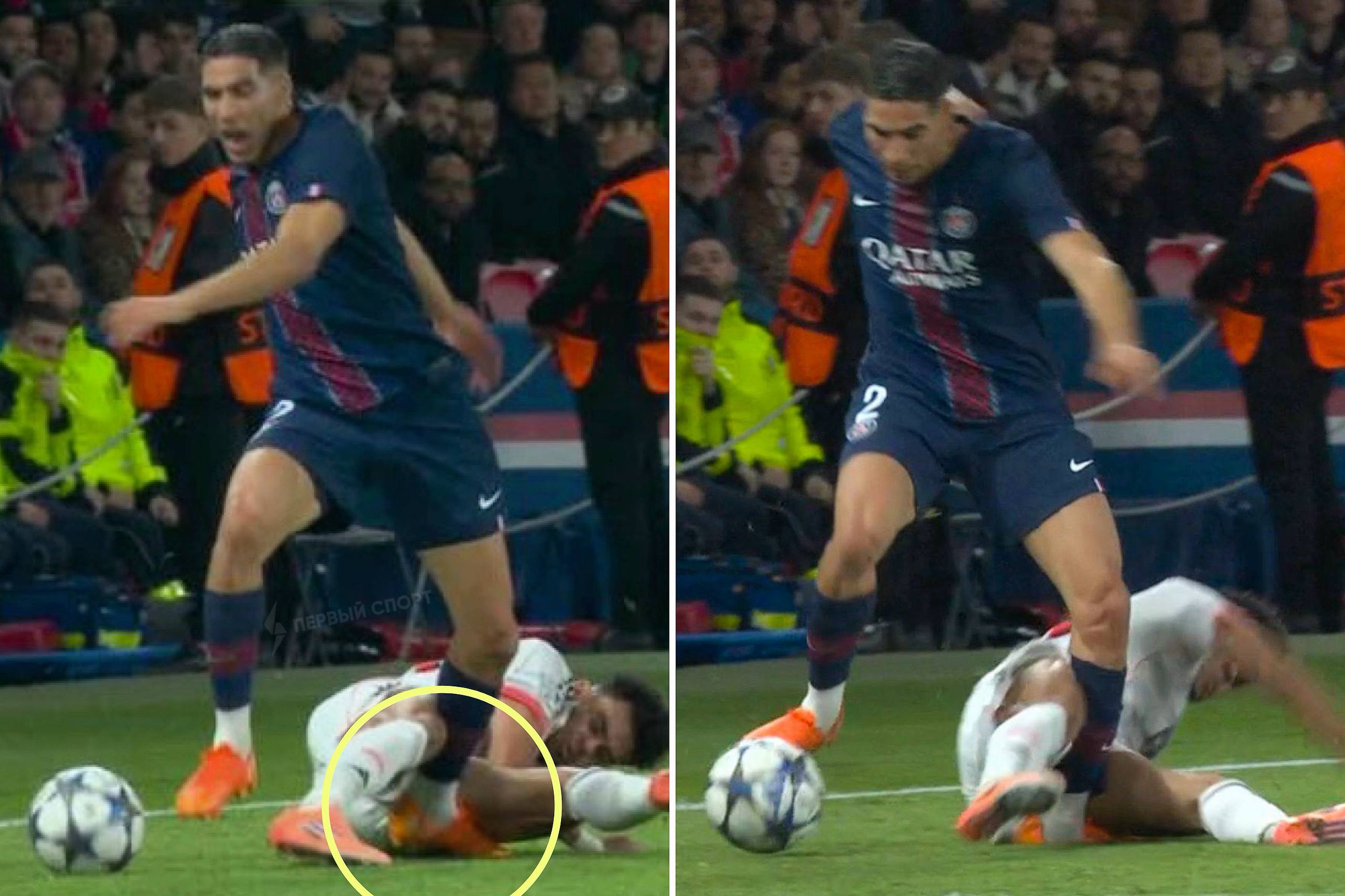 Хакими получил жуткую травму ноги в матче ЛЧ с Баварией Луис Диас влетел сзади двумя ногами в защитника ПСЖ зажевав и вывернув Ашрафу голеностоп в другую сторону Хакими у которого сегодня день рождения покинул поле в слезах и не мог ходить самостоятельно Луис Диас оформивший дубль в первом тайме получил прямую красную карточку после просмотра VAR