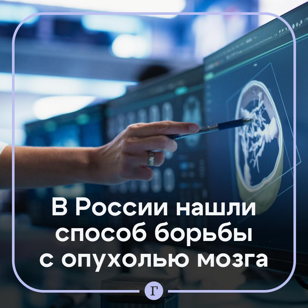 Российские врачи научились бороться с устойчивыми к химии опухолями мозга.    Глиобластома – самая распространенная и агрессивная форма, в она убивает 95% заболевших в течение пяти лет.  Подобные опухоли диагностировали у Анастасии Заворотнюк и певицы Жанны Фриске.   В РНИМУ имени Пирогова сообщили «Газете.Ru», что выяснили: глиобластому можно победить, если подавить особый белок ганкирин, который отвечает за ее агрессивное распространение. Ученые нашли способ это сделать.  Кроме того, ученые придумали, как доставить лекарство в мозг с помощью сфокусированного ультразвука. Это позволит сделать опухоль восприимчивой к лечению.    скорее бы болезнь смогли победить!