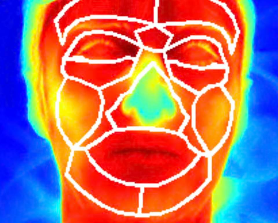 Плач младенцев повышает температуру кожи у взрослых Journal of The Royal Society Interface Подтверждаю даже мне становится не по себе Крик ребёнка способен вызвать у взрослых мгновенный эмоциональный отклик который отражается на физиологии выяснили учёные При прослушивании записей плача у людей повышалась температура кожи лица это показали данные тепловизионной съёмки Эффект усиливался если плач становился более хаотичным и резким что указывало на сильный стресс или боль у младенца Учёные считают что люди автоматически реагируют на особенности звука которые усиливаются при страдании ребёнка По словам профессора Николя Матевона из Университета Сент Этьен Франция эмоциональная реакция взрослых зависит от акустической шероховатости плача Чем больше боли в крике тем сильнее отклик нашей нервной системы Мы эмоционально воспринимаем зашифрованную в звуках информацию о боли Когда ребёнок испытывает сильный дискомфорт он резко сокращает грудную клетку воздух выходит под высоким давлением а голосовые связки начинают вибрировать хаотично В результате появляются звуки которые специалисты называют нелинейными акустическими феноменами NLP Именно они сигнализируют взрослым о страдании ребёнка Учёные проверили реакцию мужчин и женщин не имевших опыта ухода за детьми Добровольцам включали 16 разных записей плача от лёгкого дискомфорта при купании до боли при уколе Во время прослушивания участников снимали на тепловизор фиксируя малейшие изменения температуры лица Результаты показали что мужчины и женщины реагировали одинаково Наибольшие изменения температуры вызывали именно хаотичные крики независимо от их высоты Участники также чаще определяли такие записи как плач от боли а не от лёгкого неудобства Ранее никто не измерял реакцию на плач именно таким образом Пока рано говорить о практическом применении результатов но мы показали что люди бессознательно улавливают признаки боли в голосе ребёнка