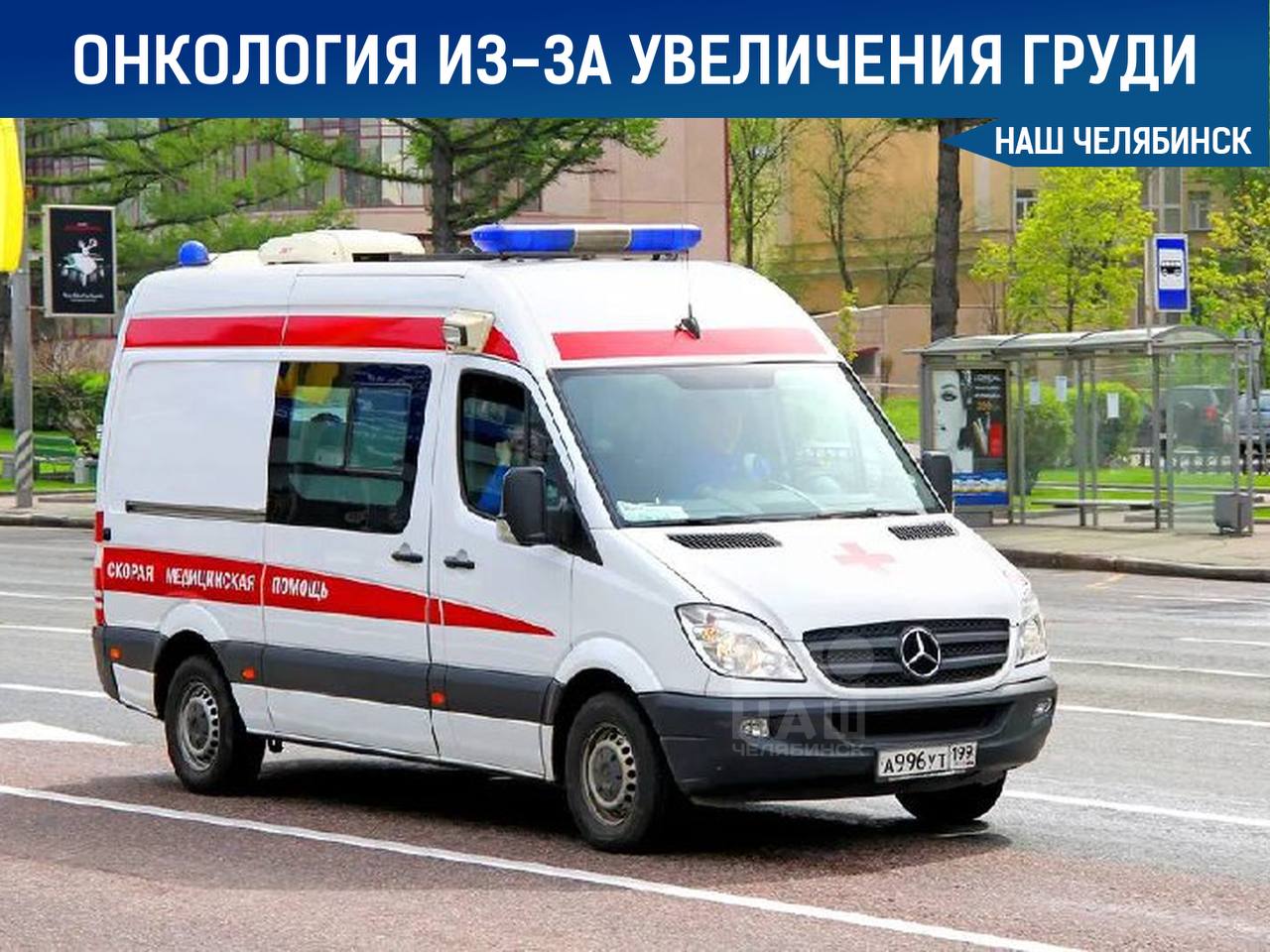 Увеличение груди привело к онкологическому заболеванию у жительницы Челябинска В регионе зафиксирован первый случай лимфомы, связанной с имплантатами, у женщины после операции по увеличению груди. В России зарегистрировано около 14–16 подобных случаев. Женщине удалили старый имплантат и установили новый. Операция была проведена в Челябинске.