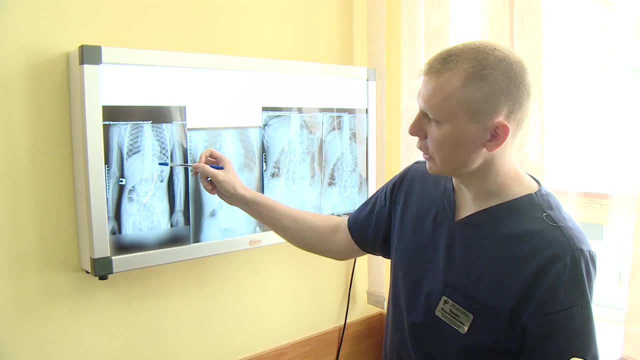 Барнаульские хирурги успешно провели операцию на четырехлетнем мальчике, извлекая более 50 магнитов