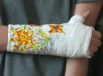 По иску прокурора несовершеннолетней возместят моральный вред    Прокуратура Сковородинского провела проверку по факту получения травмы ребенком во время урока физической культуры в МБОУ СОШ пгт. Уруша.   Установлено, что во время занятия ребенок упал и получил закрытый перелом нижнего конца лучевой кости, вследствие чего испытал физические и нравственные страдания.  Прокурор района обратился с иском о взыскании с администрации Сковородинского муниципального округа и МБОУ СОШ пгт. Уруша компенсации морального вреда, причиненного несовершеннолетней, в размере 50 тысяч рублей.  Требования прокурора удовлетворены. Исполнение решения суда на контроле в прокуратуре района.