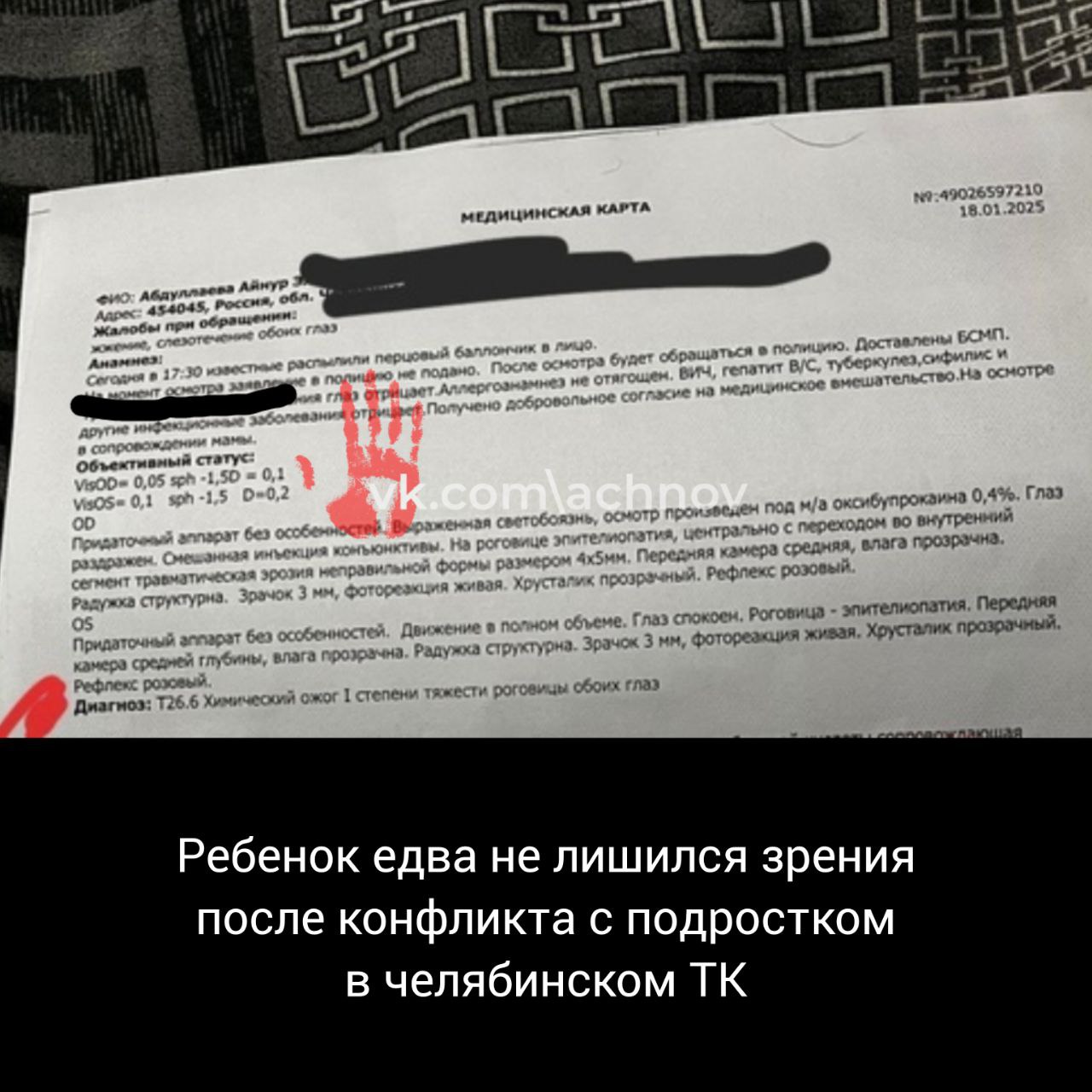 Конфликт между девочками в челябинском ТК "Кольцо" чуть не оставил одну из них без глаз!  По предварительным данным, 15-летняя особа во время словесной перепалки использовала баллончик с перцовым спреем и распылила его в лицо 12-летней девочки.  В результате пострадавшая теперь плохо видит и испытывает сильную боль.  С Агентством чрезвычайных новостей Челябинск связалась сестра пострадавшей. Она рассказала, что конфликт был обычным детским недоразумением,  драки не было. Зачем 15-летняя особа так поступила с ребенком, непонятно!   Полиция уже опросила участников конфликта и свидетелей. Также изучаются записи с камер видеонаблюдения для выяснения всех обстоятельств произошедшего. Ранее ни одна из девочек не имела проблем с законом. В настоящее время продолжается работа по установлению причин и деталей инцидента, прокомментировали в областном главке.