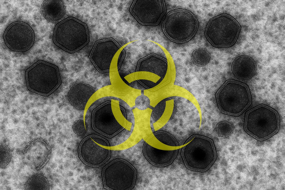 География африканской чумы свиней в соседней Молдове продолжает расширяться Очаги АЧС отмечены там уже в 13 населенных пунктах Это город Хышчешты а также ряд сел Чимишлийского Леовского Единецкого Хынчештского Каларашского Резинского Унгенского и Штефан Водского районов Ввоз свиней и свинины оттуда в Приднестровье временно запрещен mshipr